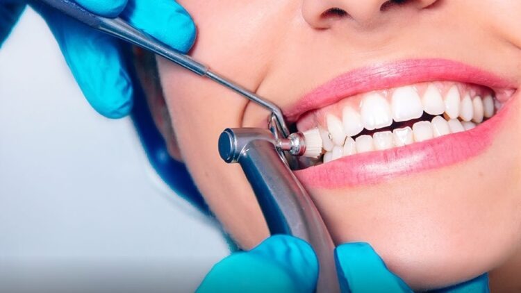 Teeth Cleaning Cost