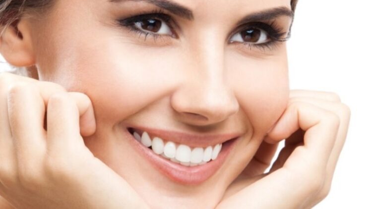 Canberra Teeth Whitening