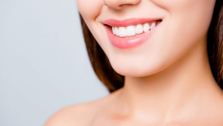 How Much Do Veneers Cost?