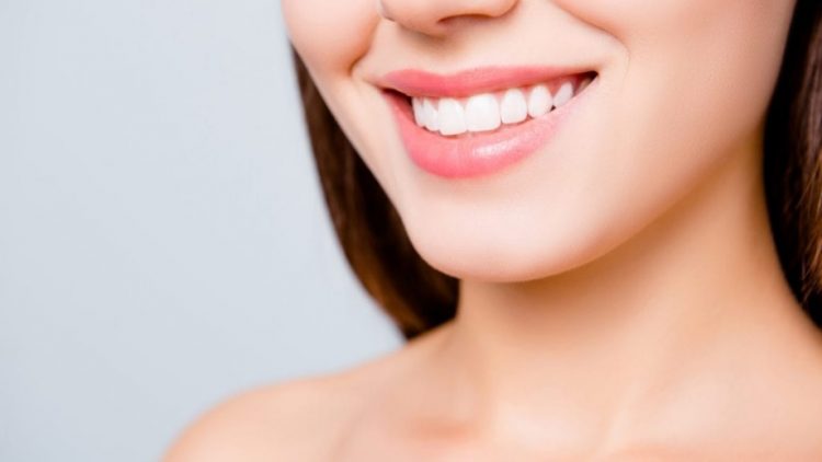 How Much Do Veneers Cost?