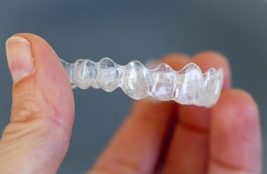 How Much Does Invisalign Cost