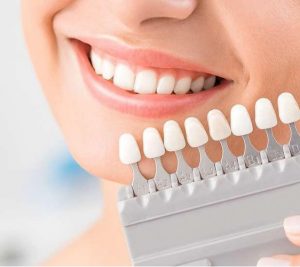 Veneers Price