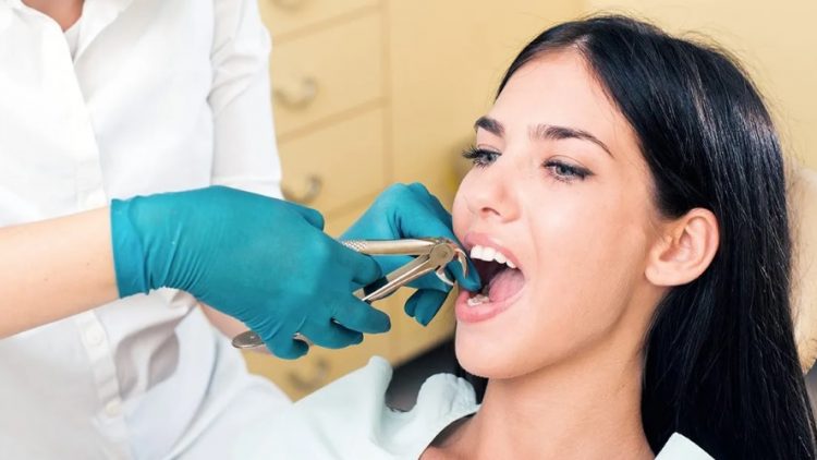 Dental Extraction