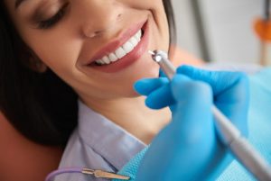 Dentist Teeth Cleaning