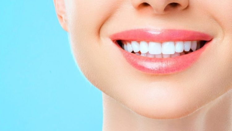 Teeth Whitening Dentist Cost