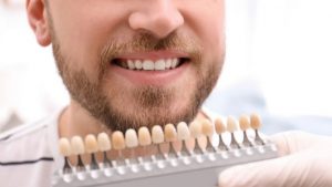 Teeth Whitening Dentist Cost