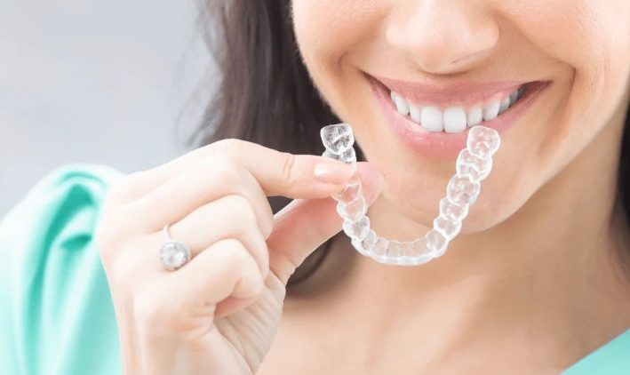Invisible Braces